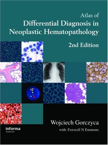 An Atlas Of Differential Diagnosis In Neoplastic Hematopathology 2nd Wojciech Gorczyca