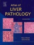 Atlas Of Liver Pathology Second Edition Atlas Of Surgical Pathology 2nd Edition Gary Kanel