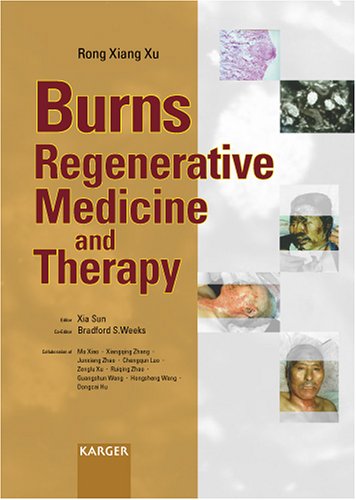 Burns Regenerative Medicine And Therapy 1st Edition Rong Xiang Xu