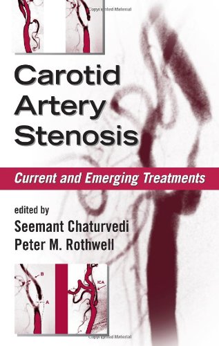 Carotid Artery Stenosis Current And Emerging Treatments Neurological Disease And Therapy 1st Edition Seemant Chaturvedi