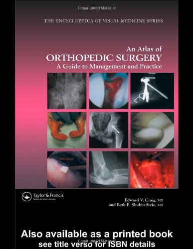 Atlas Of Orthopedic Surgery A Guide To Management And Practice Encyclopedia Of Visual Medicine Series 1st Edition Edward Vincent Craig