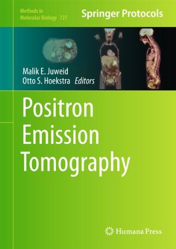 Positron Emission Tomography 1st Edition Malik E Juweid Auth