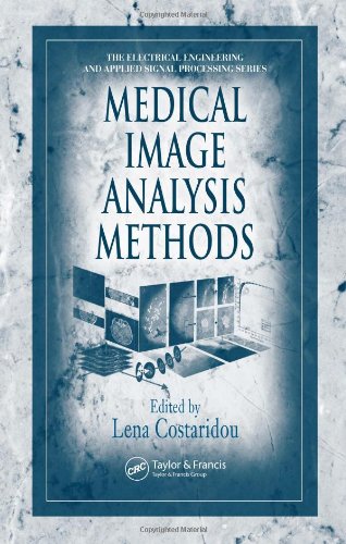 Medical Image Analysis Methods Electrical Engineering Applied Signal Processing 1st Edition Lena Costaridou