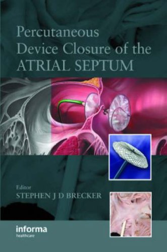Percutaneous Device Closure Of The Atrial Septum 1st Edition Stephen Jd Brecker