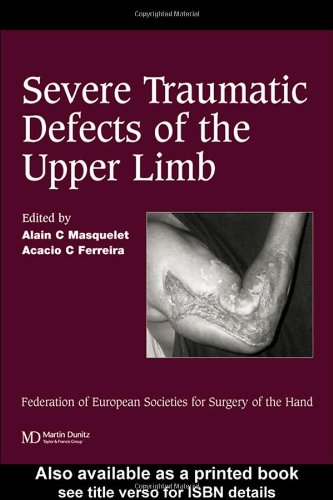 Severe Traumatic Defects Of The Upper Limb Published In Association With The Federation Of European Societies For Surgery Of The Hand Alain C Masquelet Acacio C Ferreira Federation Of European Societies For Surgery Of The Hand