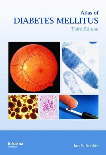 Atlas Of Diabetes Mellitus Third Edition Encyclopedia Of Visual Medicine 3rd Edition Ian N Scobie