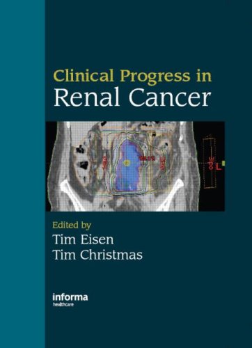 Clinical Progress In Renal Cancer 1st Edition Tim Eisen Tim Christmas