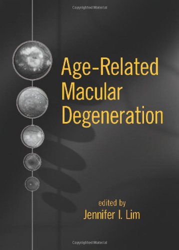 Agerelated Macular Degeneration 1st Edition Jennifer I Lim