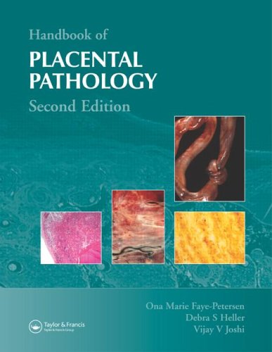 Handbook Of Placental Pathology Second Edition 2nd Edition Ona Marie Fayepetersen