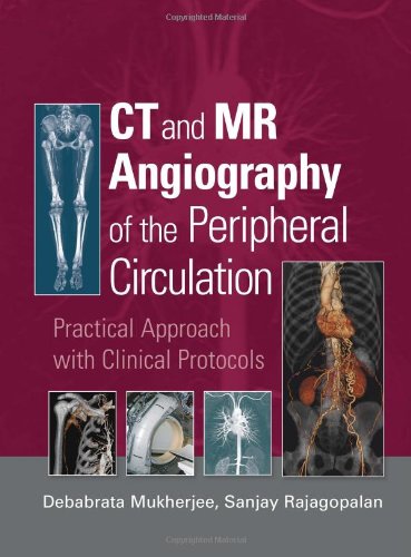 Ct And Mr Angiography Of The Peripheral Circulation Practical Approach With Clinical Protocols 1st Edition Debabrata Mukherjee