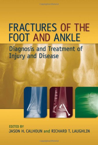 Fractures Of The Foot And Ankle Diagnosis And Treatment Of Injury And Disease 1st Edition Jason H Calhoun