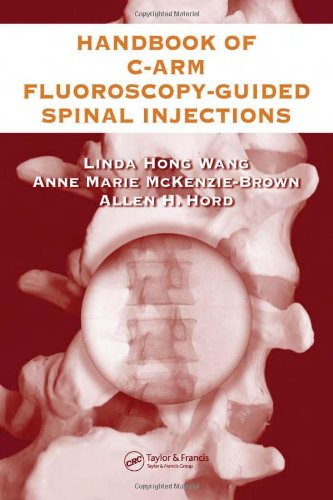 The Handbook Of Carm Fluoroscopyguided Spinal Injections 1st Edition Md