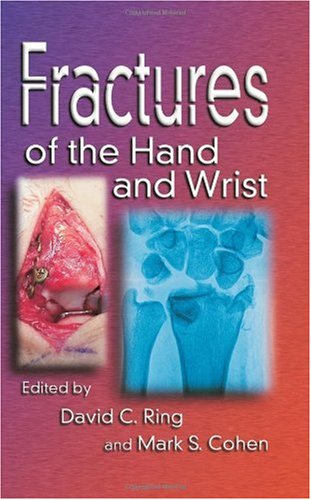 Fractures Of The Hand And Wrist 1st Edition David C Ring Mark Cohen
