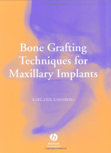 Bone Grafting Techniques For Maxillary Implants 1st Edition Karlerik Kahnberg