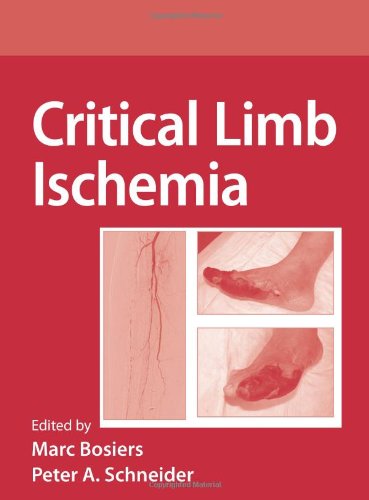 Critical Limb Ischemia 1st Edition Peter Schneider Marc Bosiers