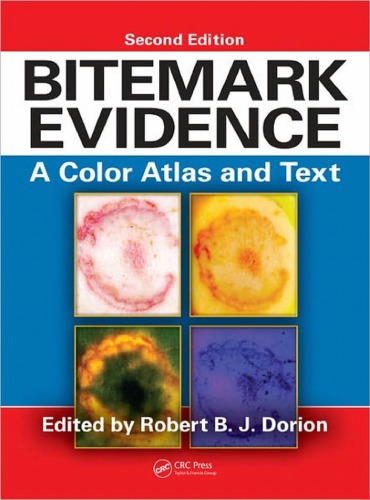 Bitemark Evidence A Color Atlas And Text 2nd Edition International Forensic Science 2nd Edition Robert Bj Dorion