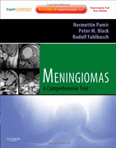 Meningiomas Expert Consult Online And Print Expert Consult Title Online Print 1 Harpsc M Necmettin Pamir