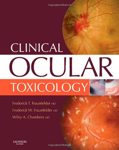 Clinical Ocular Toxicology Druginduced Ocular Side Effects 1st Edition Frederick T Fraunfelder Md