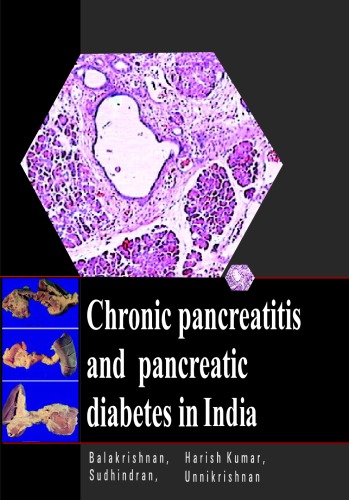 Chronic Pancreatitis And Pancreatic Diabetes In India V Balakrishnan Md
