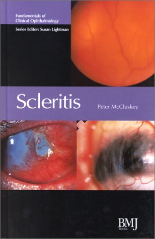 Scleritis Fundamentals In Clinical Ophthalmology 1st Edition Peter Mccluskey