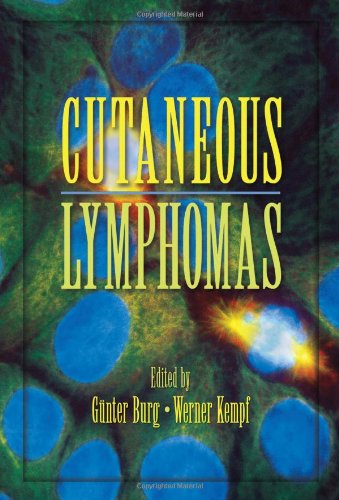 Cutaneous Lymphomas Basic And Clinical Dermatology 1st Edition Gunter Burg Editor