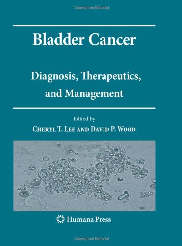 Bladder Cancer Diagnosis Therapeutics And Management 1st Edition J Stephen Jones Auth