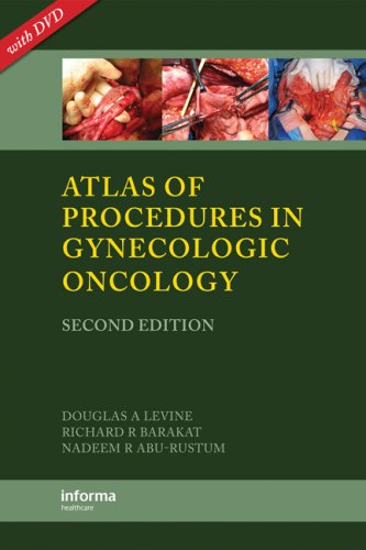 Atlas Of Procedures In Gynecologic Oncology Second Edition 2nd Edition Douglas A Levine
