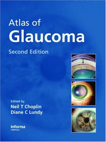 Atlas Of Glaucoma Second Edition 2nd Edition Neil T Choplin