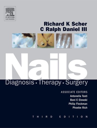 Nails Diagnosis Therapy Surgery Third Edition 3rd Edition Richard K Scher Md