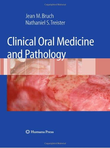 Clinical Oral Medicine And Pathology 1st Edition Jean M Bruch