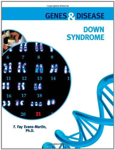 Down Syndrome Genes And Disease 1st Edition F Fay Evansmartin