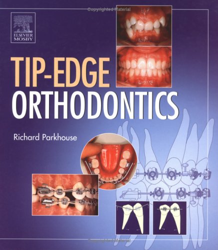 The Tipedge Orthodontic System 1st Edition Richard Parkhouse