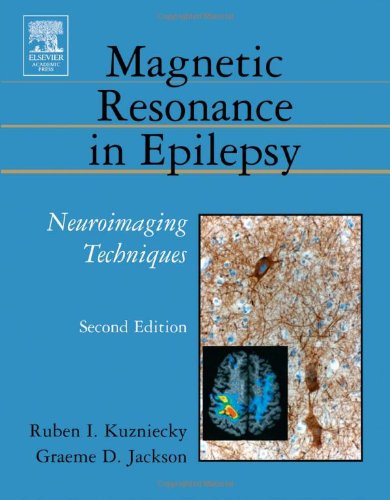 Magnetic Resonance In Epilepsy Second Edition Neuroimaging Techniques Second Edition 2nd Edition Ruben Kuzniecky