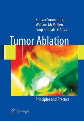 Tumor Ablation Principles And Practice 1st Edition Eric Vansonnenberg