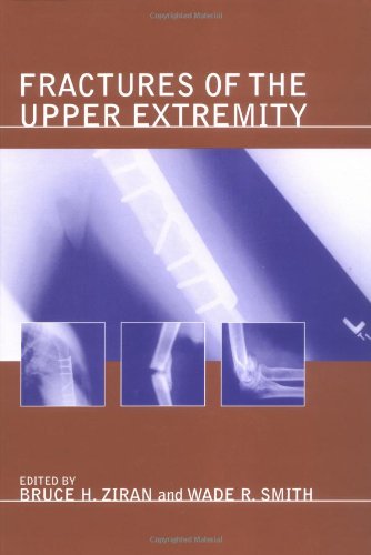Fractures Of The Upper Extremity 1st Edition By Bruce H Ziran Editor