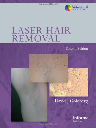 Laser Hair Removal Second Edition Series In Cosmetic And Laser Therapy 2nd Edition David J Goldberg
