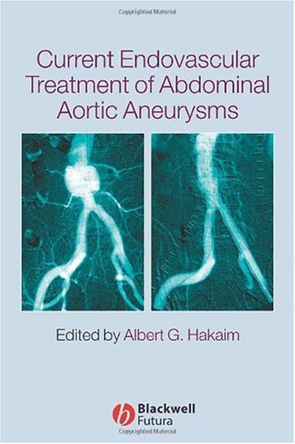 Current Endovascular Treatment Of Abdominal Aortic Aneurysms 1st Edition Albert G Hakaim