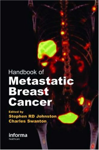 Handbook Of Metastatic Breast Cancer 1st Edition Stephen Johnston