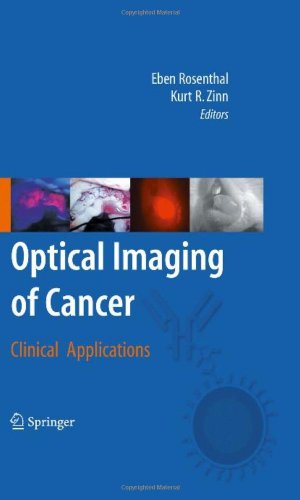 Optical Imaging Of Cancer Clinical Applications 1st Edition Kent T Keyser