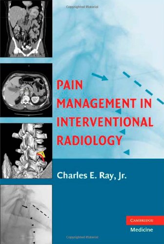 Pain Management In Interventional Radiology 1st Edition Jr Charles E Ray