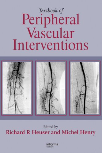 Textbook Of Peripheral Vascular Interventions Second Edition 2nd Edition Richard R Heuser
