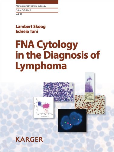 Fna Cytology In The Diagnosis Of Lymphoma Monographs In Clinical Cytology Vol 18 1st Edition Lambert Skoog