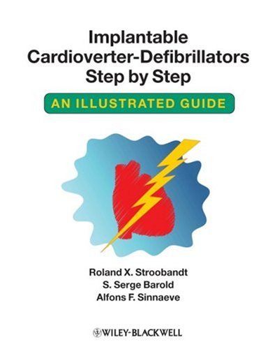 Implantable Cardioverterdefibrillators Step By Step An Illustrated Guide 1st Edition Roland X Stroobandt