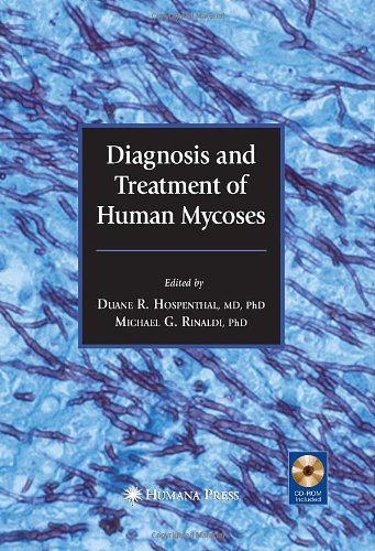 Diagnosis And Treatment Of Human Mycoses Infectious Disease 1st Edition Duane R Hospenthal