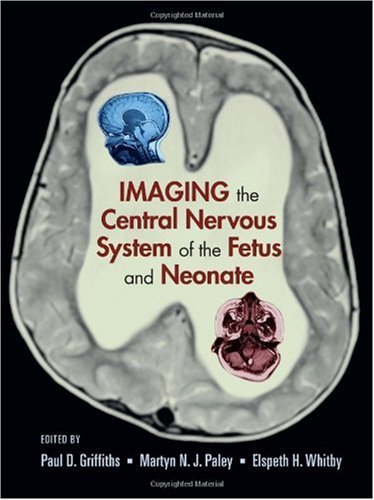 Imaging The Central Nervous System Of The Fetus And Neonate 1st Edition Paul D Griffiths