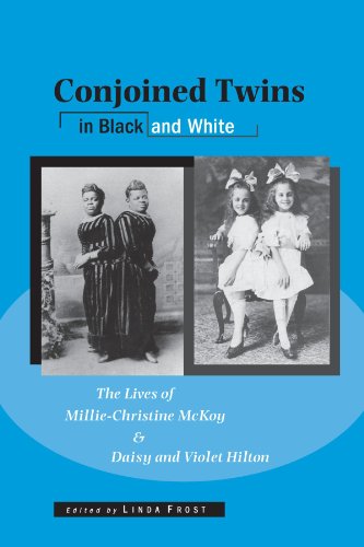 Conjoined Twins In Black And White The Lives Of Milliechristine Mckoy And Daisy And Violet Hilton Wisconsin Studies In Autobiography 1st Edition Linda Frost