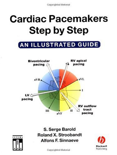 Cardiac Pacemakers Step By Step An Illustrated Guide S Serge Barold