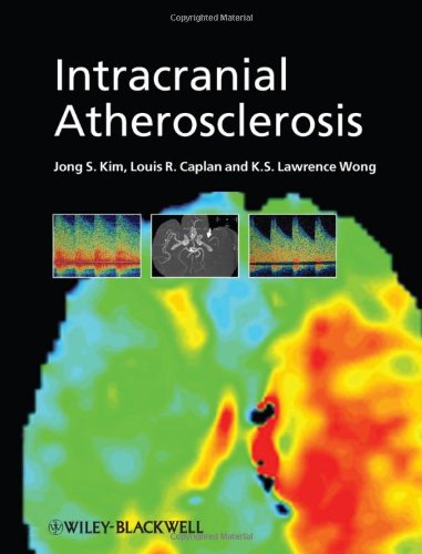 Intracranial Atherosclerosis 1st Edition Jong S Kim Louis R Caplan