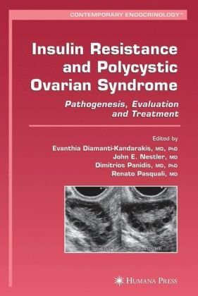 Insulin Resistance And Polycystic Ovarian Syndrome Pathogenesis Evaluation And Treatment Contemporary Endocrinology 1st Edition Evanthia Diamantikandarakis