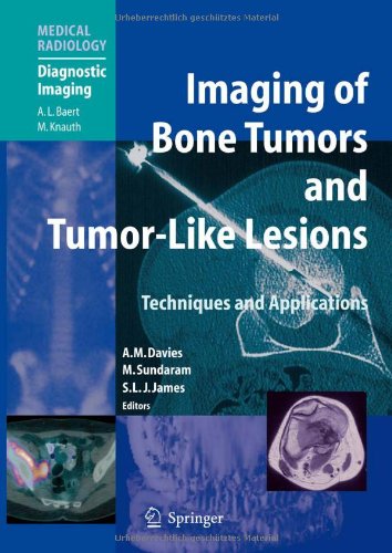 Imaging Of Bone Tumors And Tumorlike Lesions Techniques And Applications 1st Edition Lars Gunnar Kindblom Auth